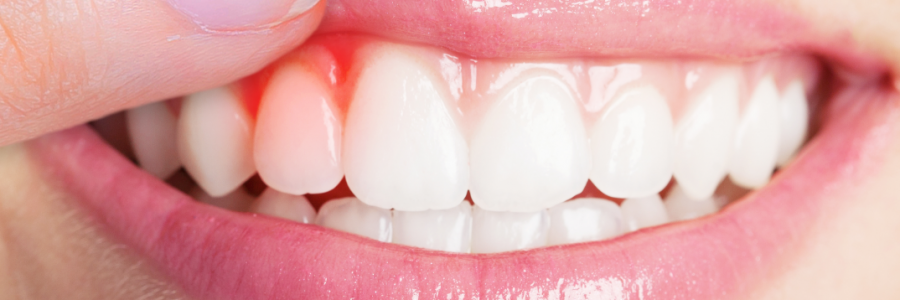 又上火又怕冷？上熱下寒、水火不濟(jì)，教你調(diào)回來！