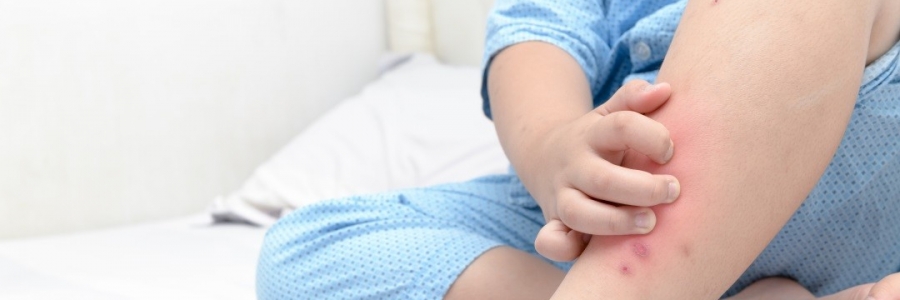 學(xué)古人這樣驅(qū)蚊，從此不再“蚊”風(fēng)喪膽！