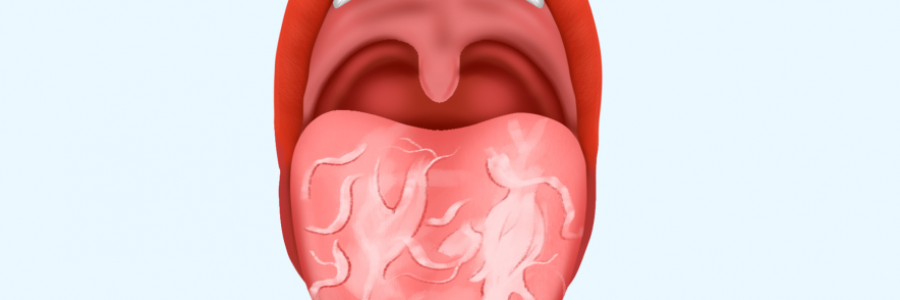 舌苔辨識(shí)“九種中醫(yī)體質(zhì)”（配圖）