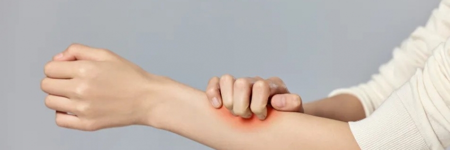 濕疹、瘙癢、蕁麻疹……患皮膚病，也許是好事！